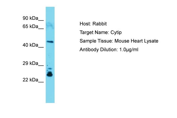 Polyclonal Rabbit anti-Mouse CYTIP Antibody (C-Terminus, WB)