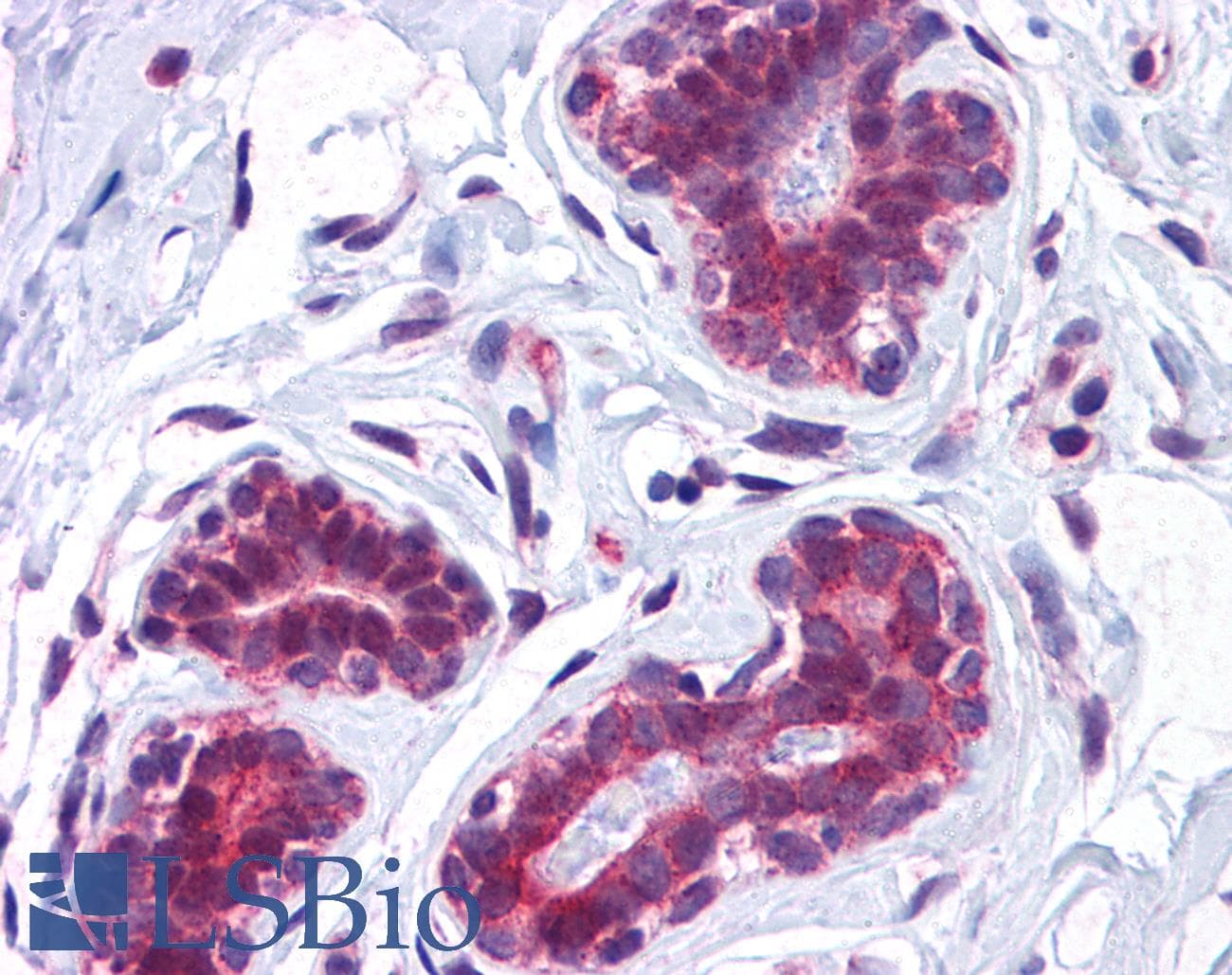 IHC-plus™ Polyclonal Rabbit anti-Human CCDC106 Antibody (IHC, IF, WB)