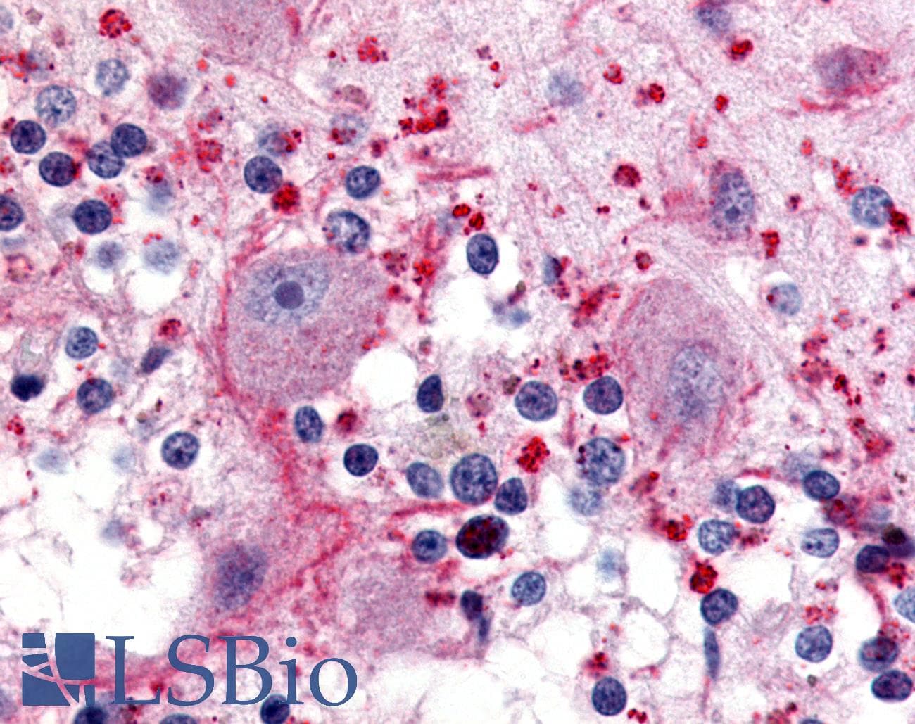 IHC-plus™ Polyclonal Rabbit anti-Human HTR5A / 5-HT5A Receptor Antibody (Cytoplasmic Domain, IHC)