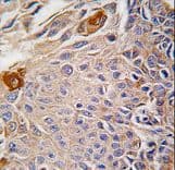 Polyclonal Rabbit anti-Human RMND5B Antibody (aa347-375, IHC, WB)