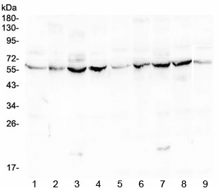 Lumican Antibody