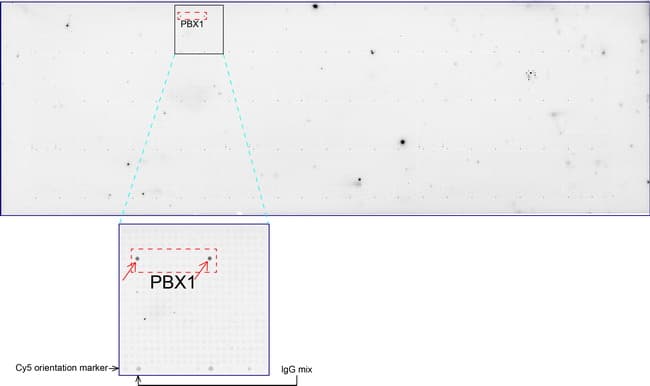 Monoclonal Mouse anti-Human PBX1 Antibody (clone UMAB111, IHC, IF)