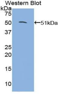 NR3C1/Glucocorticoid Receptor Antibody (aa598-755)