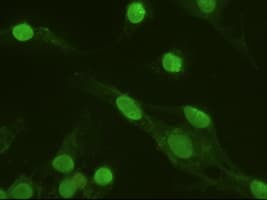 Monoclonal Mouse anti-Human MAPK6 / ERK3 Antibody (clone OTI5E1, IF, WB)