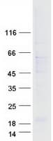 Human ARL13B Protein (Recombinant Myc-DDK (Flag))