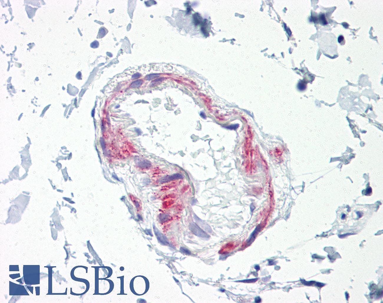 IHC-plus™ ADGRL2 / LPHN2 Antibody (aa551-600)