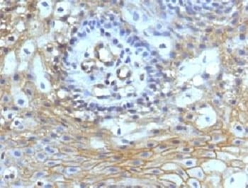 CD59 Antibody (clone CDLA59-1)