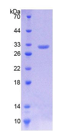 Human KLF5 / BTEB2 Protein (Recombinant His-T7)