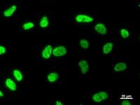 MATR3 / Matrin 3 Antibody (clone 2539C3a)