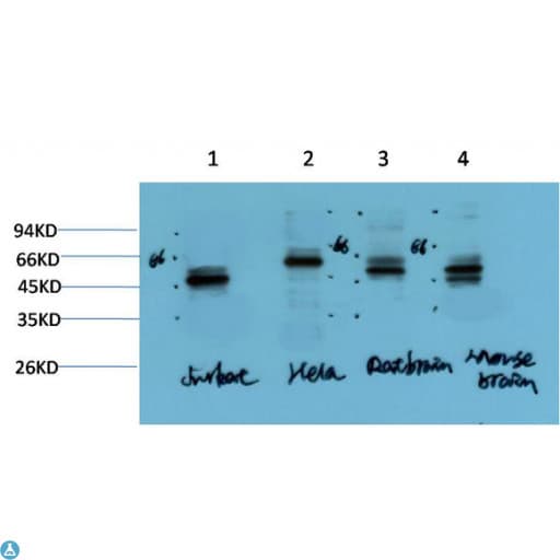 Monoclonal Mouse anti-Human TUBG1 / Tubulin Gamma 1 Antibody (IHC, WB)
