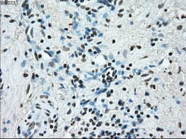 ERCC1 Antibody (clone OTI1A3)