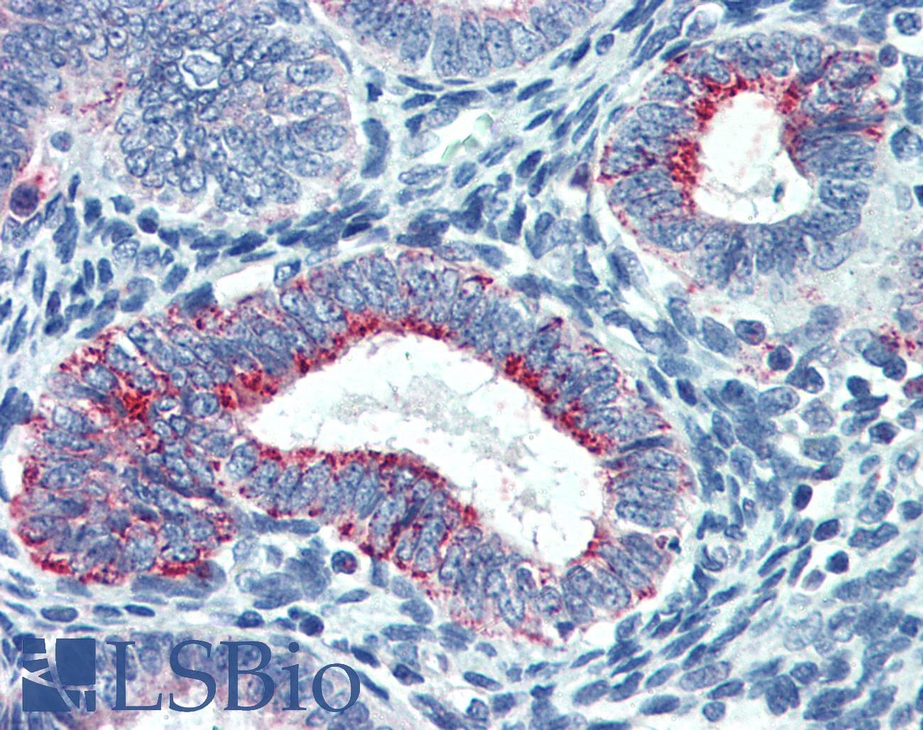 IHC-plus™ TS / Thymidylate Synthase Antibody (clone 2B2)