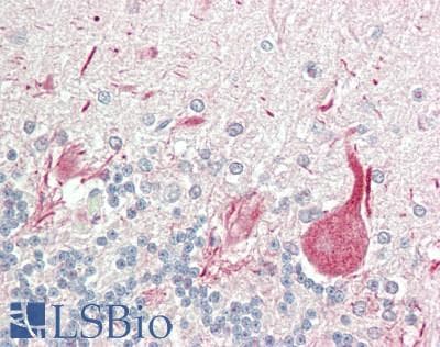IHC-plus™ Polyclonal Rabbit anti-Human NOTCH3 Antibody (IHC, IF, WB)