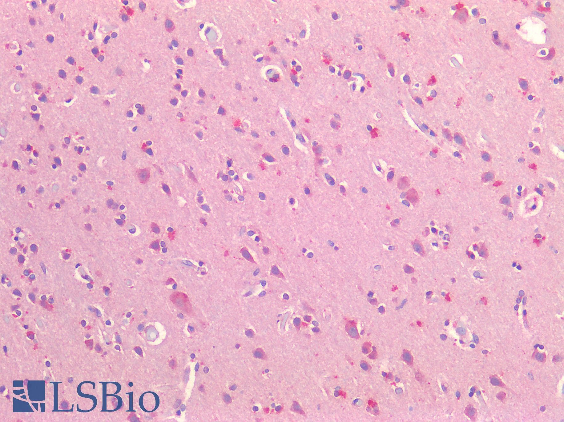 IHC-plus™ NOTCH2 Antibody