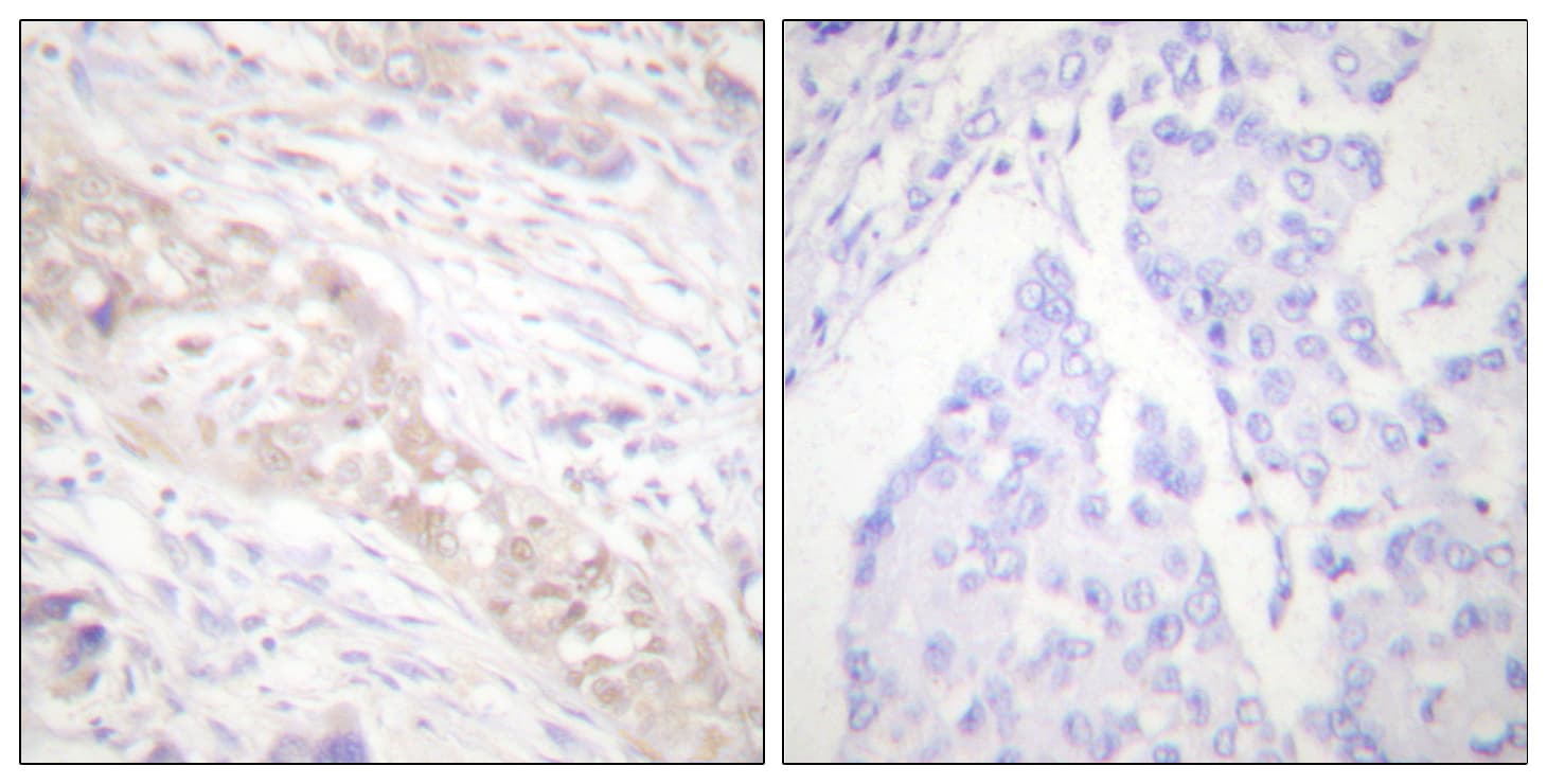 SMAD2 Antibody (phospho-Ser467)