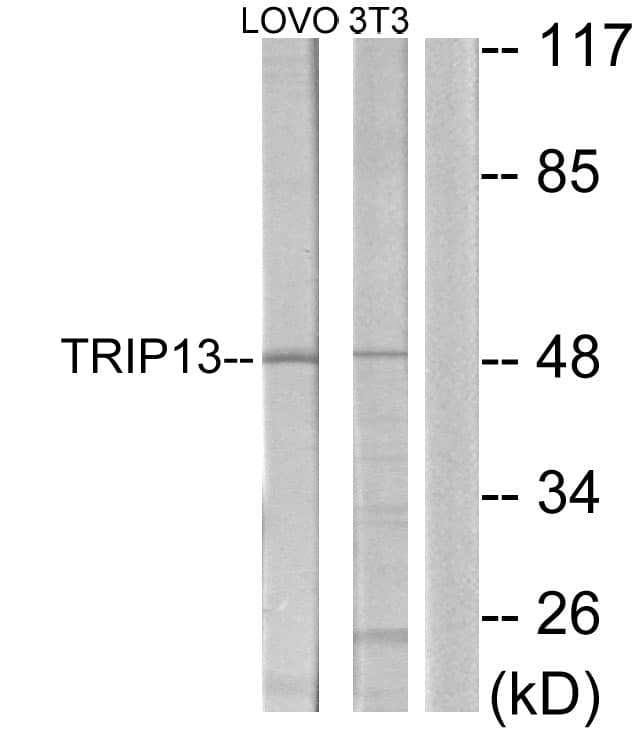 Polyclonal Rabbit anti-Human TRIP13 Antibody (aa383-432, WB)