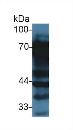 VTN / Vitronectin Antibody (aa21-400, Biotin)