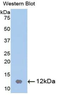 CSTB / Cystatin B / Stefin B Antibody (aa2-98)