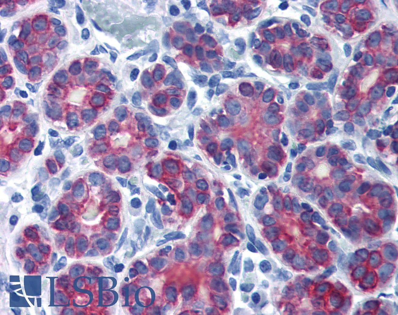 PathPlus™ Polyclonal Rabbit anti-Human KRT7 / CK7 / Cytokeratin 7 Antibody (N-Terminus, IHC)