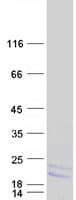 Human LY6H Protein (Recombinant Myc-DDK (Flag))
