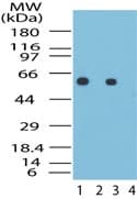 IHC-plus™ Polyclonal Rabbit anti-Human HSPD1 / HSP60 Antibody (aa350-400, IHC, WB)