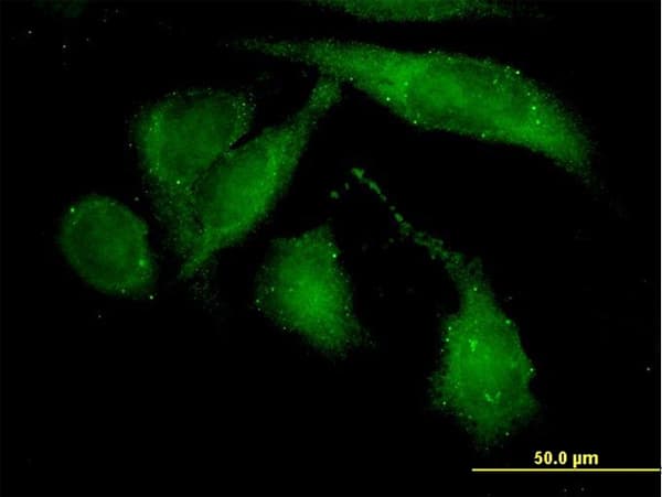 IHC-plus™ ROCK2 Antibody (clone 1E12)