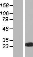 PXMP4 Protein (Over-Expression Lysate Myc-DDK (Flag))