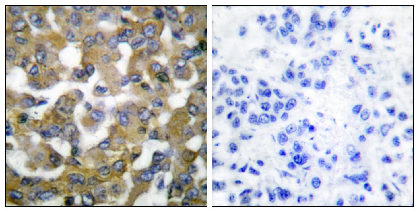 KRT19 / CK19 / Cytokeratin 19 Antibody