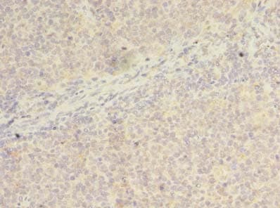 WDR37 Antibody