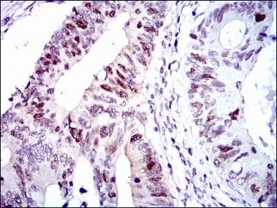 Monoclonal Mouse anti-Human CDK2 Antibody (clone 1A6, IHC, IF, WB)