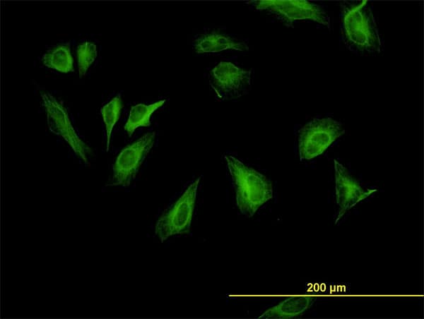 IHC-plus™ RPS6KB1 / P70S6K / S6K Antibody (clone 1E12)