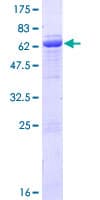 Human GNA11 Protein (Recombinant GST)