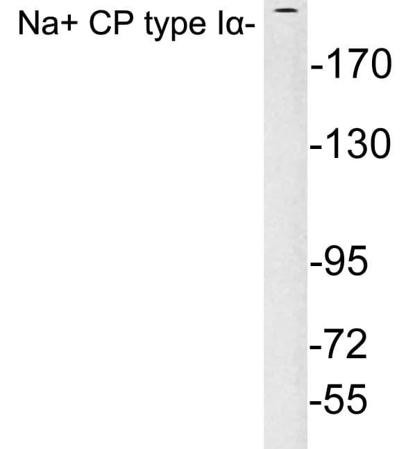 Polyclonal Rabbit anti-Human SCN1A / Nav1.1 Antibody (aa33-82, WB)
