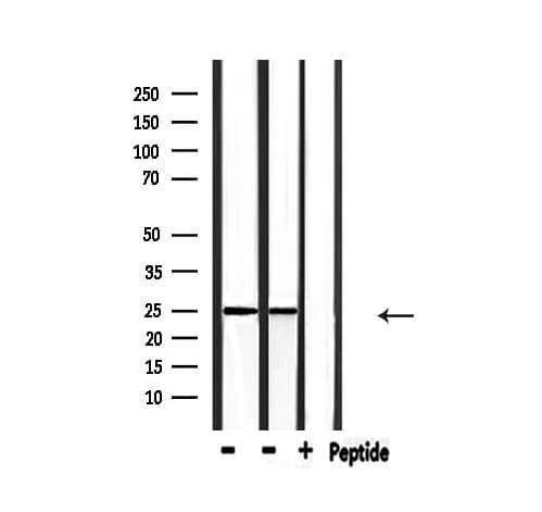 RIT1 Antibody