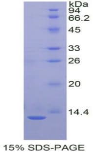 Rabbit IL8 / Interleukin 8 Protein (Recombinant His-T7)