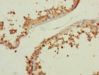 CETN3 Antibody