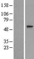 CCDC7 / C10orf68 Protein (Over-Expression Lysate Myc-DDK (Flag))