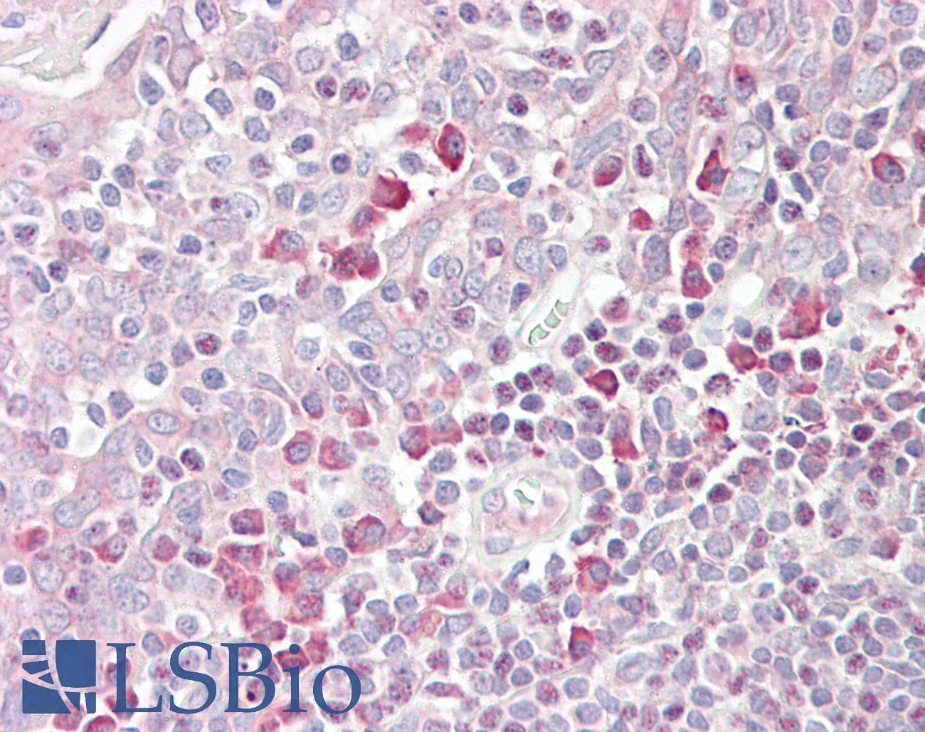 IHC-plus™ MARCH6 / DOA10 Antibody (aa886-898)