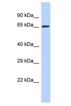 Polyclonal Rabbit anti-Human FOXK2 / ILF Antibody (aa356-405, WB)