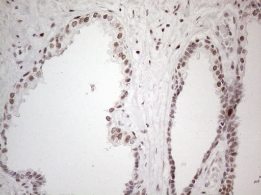TP53BP1 / 53BP1 Antibody (aa1-300, clone OTI5E1)