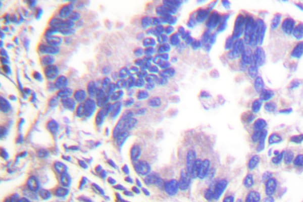Polyclonal Rabbit anti-Human SNCG / Gamma-Synuclein Antibody (Ala111, IHC, WB)