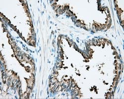 Monoclonal Mouse anti-Human DNTTIP1 / TDIF1 Antibody (clone OTI1F4, IHC, IF, WB)