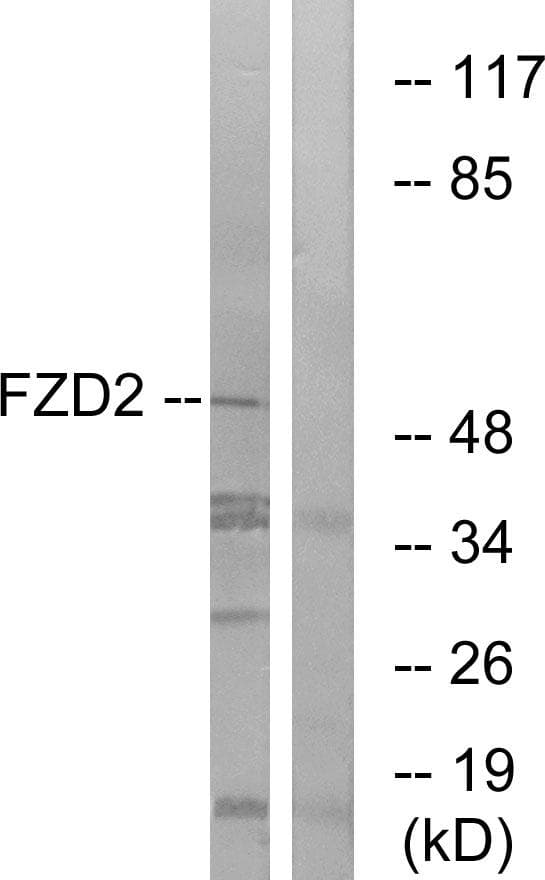 FZD2 / Frizzled 2 Antibody