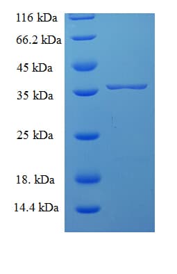 Human SNX24 Protein (Recombinant His-SUMO)