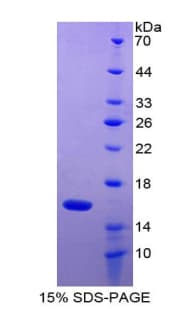 Human GDF2 / BMP9 Protein (Recombinant His)
