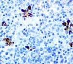 Monoclonal Mouse anti-Human PRF1 / Perforin Antibody (clone 5B10, IHC)