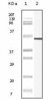 Vimentin Antibody (clone 9E7E7,)