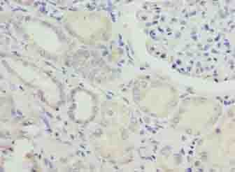 NUPL2 Antibody