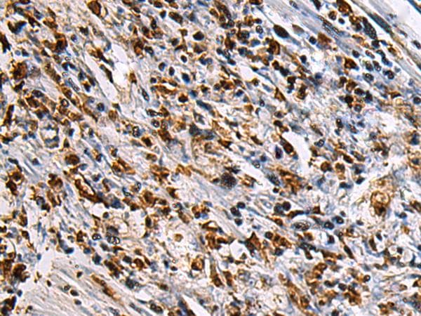 SAV1 / WW45 Antibody