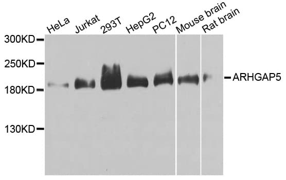 ARHGAP5 / RhoGAP5 Antibody